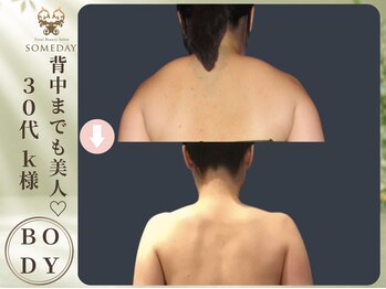 サムデイ プレミアム 新宿西口店(SOMEDAY)/BODY