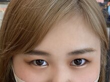 ビューティーガーデン イース/BEFORE