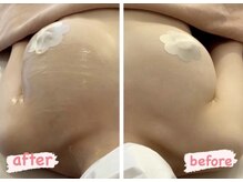 エムエム(mm)/NR機器/プラチナラジオ波