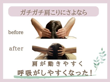 ミトラ(MITRA)の写真
