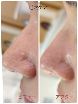 ラヴィアンローズ 蒲郡店(& La vie en Rose)/毛穴ケア