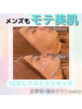 メリー 大和八木店(merry)/メンズも◎モテフェイスへ☆