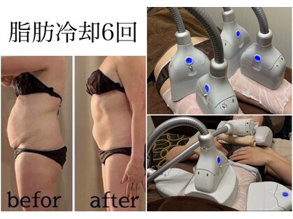 エバーグリーン(Evergreen)の写真