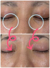 プログレス(PROGRESS)/目元のクマケア