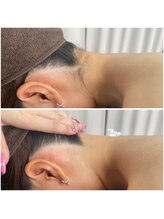 ミース 北九州店/うなじ◎ビフォーアフター