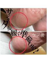 ルアナネイル(Luana Nail)/サンダル履く準備OK?!見逃し注意