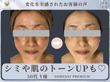 サムデイ プレミアム 新宿西口店(SOMEDAY)/FACE