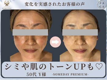 サムデイ プレミアム 新宿西口店(SOMEDAY)/FACE