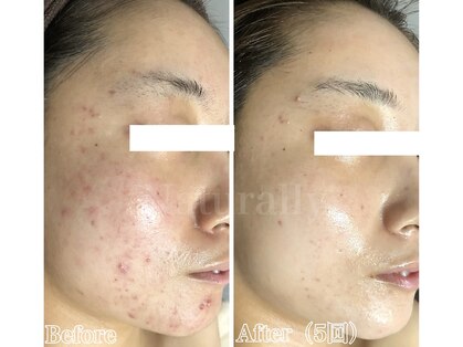 ナチュラリー 佐賀(Naturally)の写真