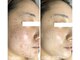 ナチュラリー 佐賀(Naturally)の写真