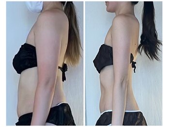 カーム(CALM.)/上半身スッキリ！