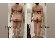 プリマ(Prima)/BEFORE&AFTER