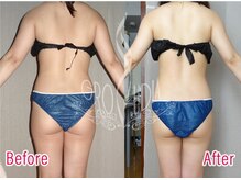 グラウディア 恵比寿/痩身/筋膜リリース/インディバ超