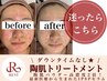 【リピーター様】REVI最高峰ケア★ハーブピーリング+IPSP美容液導入でハリ感