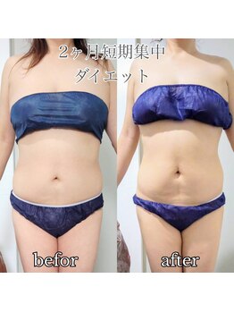 プレミア ボーテ (PREMIER BEAUTE)/痩身90分8回コース