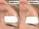ワイシーハッチ(yc.hacci)の写真/《後悔させない肌質改善》"REVI*ハーブピーリング&よもぎ蒸し"で内側から綺麗に◇憧れのハリツヤ美肌へ。