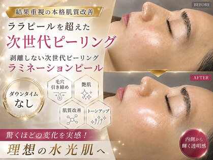 オンフリーク(ON FLEEK)の写真