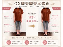 練馬アカデミア美容整体院/ダイエット・下半身ダイエット