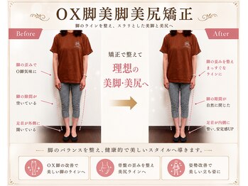 練馬アカデミア美容整体院/ダイエット・下半身ダイエット