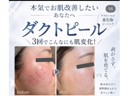 クレモール(CREMOR)の写真