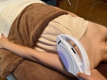 リノ(Lino)/うで脱毛