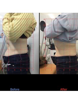 京成臼井駅前ひまわり整骨院/☆スタイル変化の写真☆