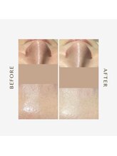 オーシャン(OCEAN)/before after