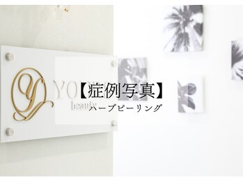 ユアーズ ビューティー(YOURS beauty)/