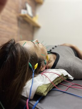 わきさか鍼灸整骨院・鍼灸院 レーヴ(Reve)/個室でゆっくり自分時間♪