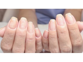 キャンアイドレッシー 草加店(Can I Dressy)/自爪育成「最強のネイルケア」