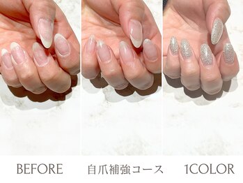 丁寧な”カウンセリング＆ケア”