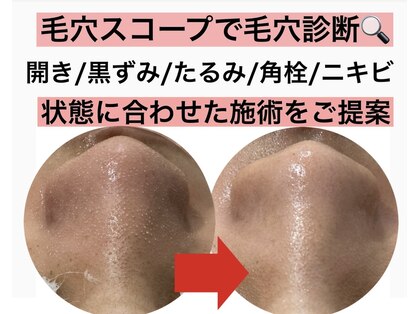 スイ(sui)の写真