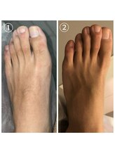 クサカンムリ(KUSAKANMURI)/男性足の甲