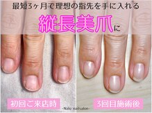 【深爪矯正・自爪育成専門サロン】Nalu.nailsalon