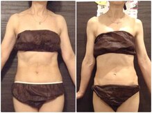 ウェリナ平和堂長久手院/小顔矯正/骨盤矯正/美脚サロン