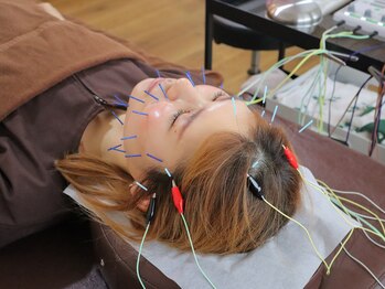 こと鍼灸院・整骨院/強さなどご相談OK