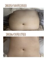 オン 絹(on silk)/ボディ施術月１回＋ホームケア