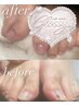 【男性はこちら♪角質が気になる方おすすめ】メンズフット