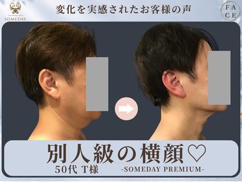 サムデイ プレミアム 新宿西口店(SOMEDAY)/FACE