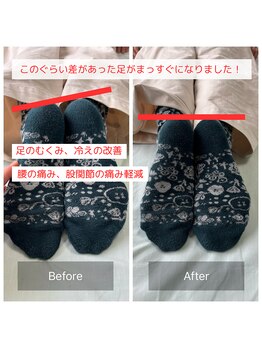 カルラ(KARURA)/股関節や足の位置も骨盤矯正で！