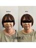 人気No.1【小顔矯正30分】左右差/歪み/むくみ改善/肩コリ/腰痛にアプローチ◎
