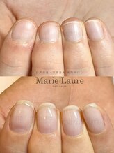マリーロール 淀屋橋本店(Marie Laure)/自爪育成/深爪矯正/ネイルケア
