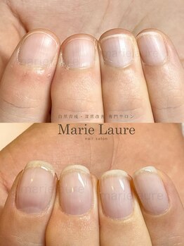 マリーロール 淀屋橋本店(Marie Laure)/自爪育成/深爪矯正/ネイルケア