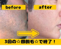 ボディステップ 調布(BODYSTEP)
