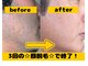ボディステップ 調布(BODYSTEP)の写真