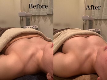 ジェイオー(J.O)/バストアップコルギ/小顔コルギ