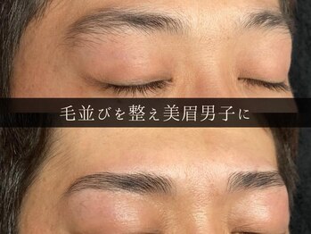 ユー 千葉駅前店(you)/ビフォーアフター写真