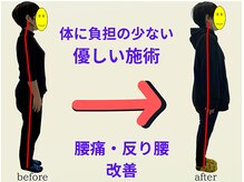とりまる整体院 アイワイ(iy)/腰痛・反り腰改善