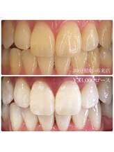 ホワイトニングルーム 川崎店(WhiteningRoom)/ホワイトニング/川崎　