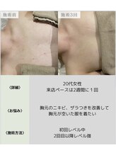 サロンエヌ 久留米店(Salon N)/デコルテ美人に◎